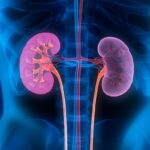 Understanding and Managing Chronic Kidney Disease (CKD) Chronic Kidney Disease