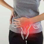 What is PCOD and PCOS? Are they same? PCOD