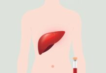 High Alkaline Phosphatase: What One Result Can Tell You High alkaline phosphatase result with liver and bone shown as possible sources