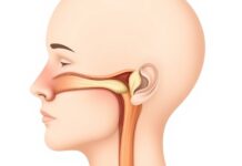 Sinus Infection: When Antibiotics Help—and When to Wait Medical illustration of inflamed sinuses showing when sinus infection antibiotics may be considered