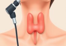 Thyroid Nodules on Scans: When Follow-Up Makes Sense Ultrasound of the thyroid gland showing a small nodule being assessed
